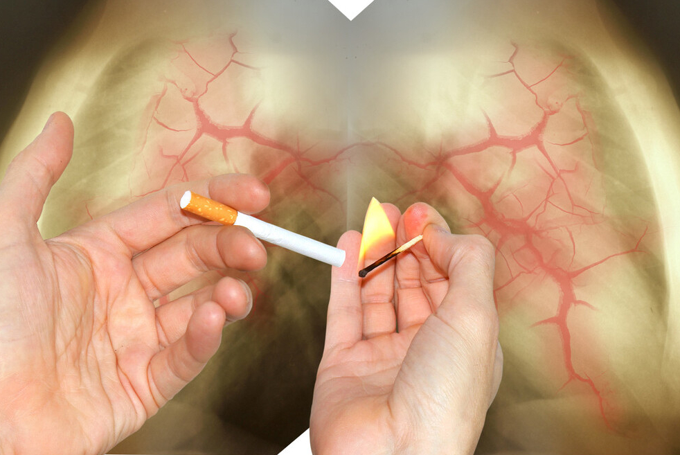 电子烟真的无害吗？电子烟和传统香烟，谁的危害更大？