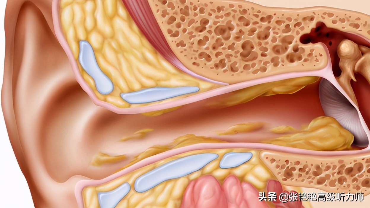 为什么有的人耳朵会“出油”？是病吗？最全解答快接收