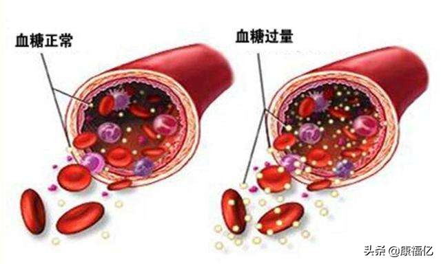 康福亿健康小知识：菊粉是什么，功效与作用如何