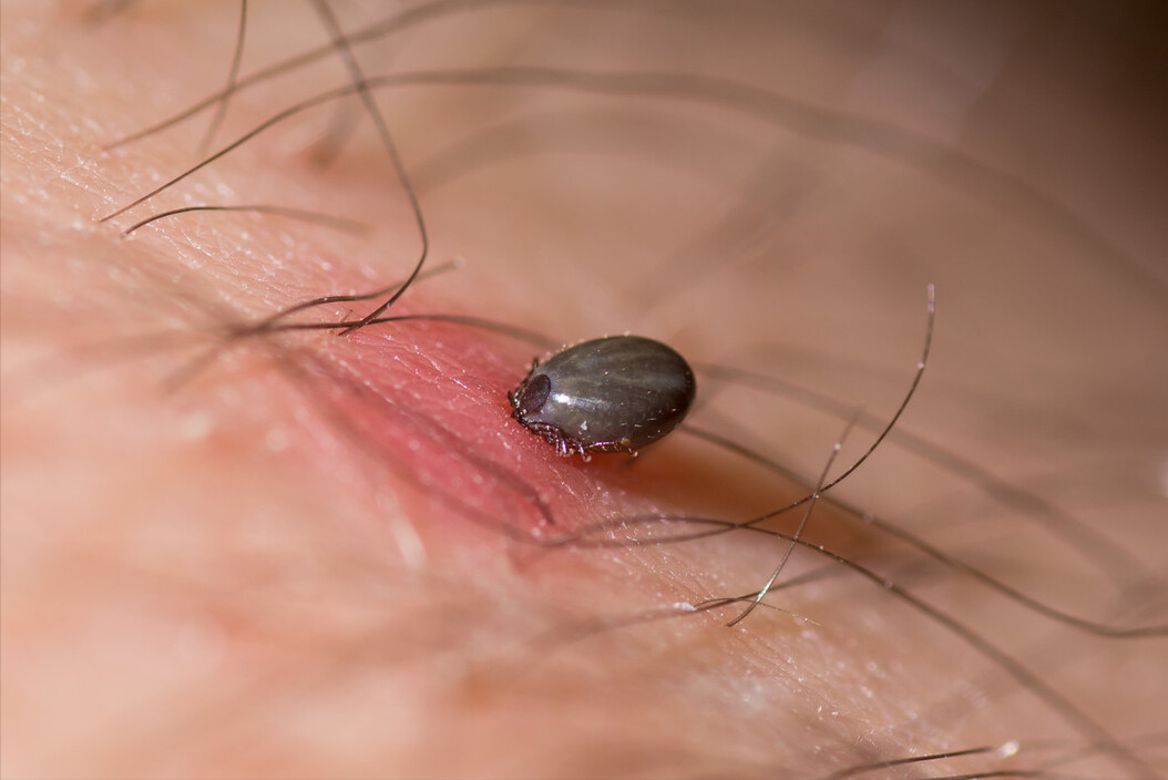 当心！进入蜱虫叮咬高发期，如果被蜱虫叮咬后该如何处理？
