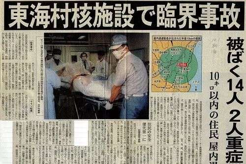 比凌迟更惨的死法！日本男子意外遭受核辐射，83天后全身溃烂而亡