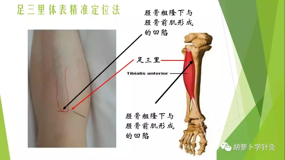 用这个方法，100%找准足三里