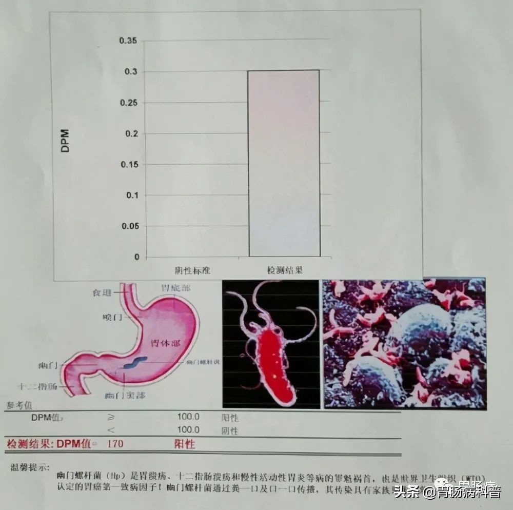 幽门螺杆菌呼气试验，有没有假阳性？数值越大，就越严重吗？