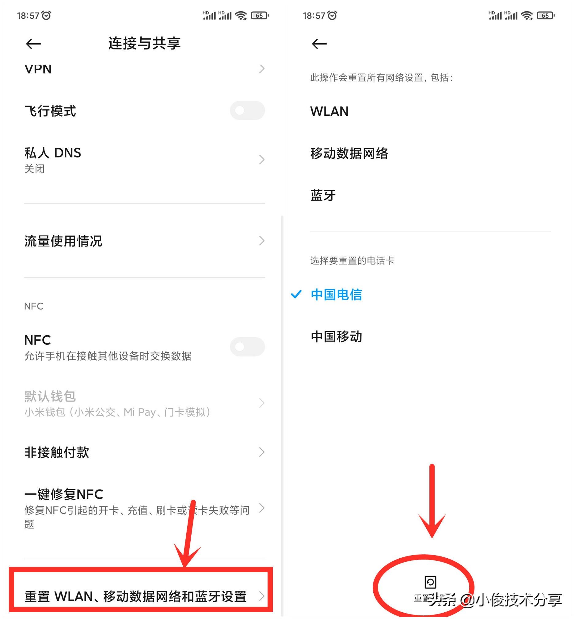 手机“wifi”明明已连接，却还是上不了网？教你4招，轻松搞定