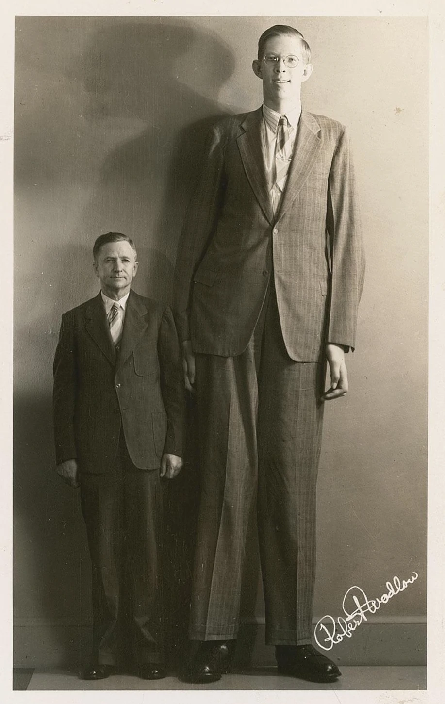 盘点全球最高的十个人，身高的背后是常人难以想象的病痛折磨