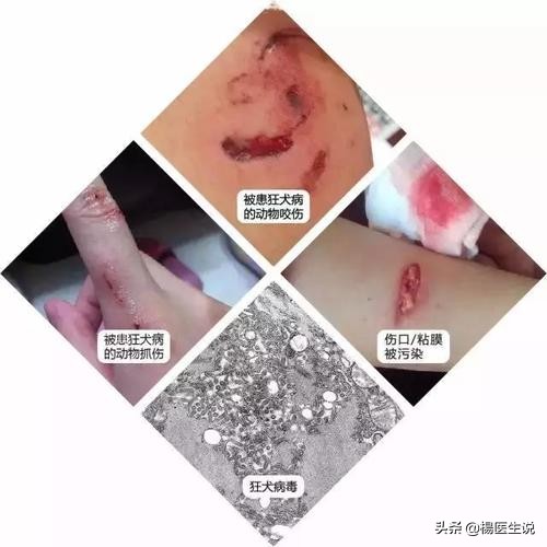 被猫狗咬了，没有及时打狂犬疫苗，要紧吗？