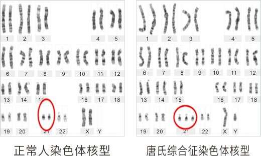 比凌迟更惨的死法！日本男子意外遭受核辐射，83天后全身溃烂而亡