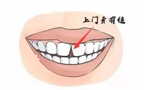 牙齿影响运势？快来看你牙齿代表什么，教你从牙齿看富贵相